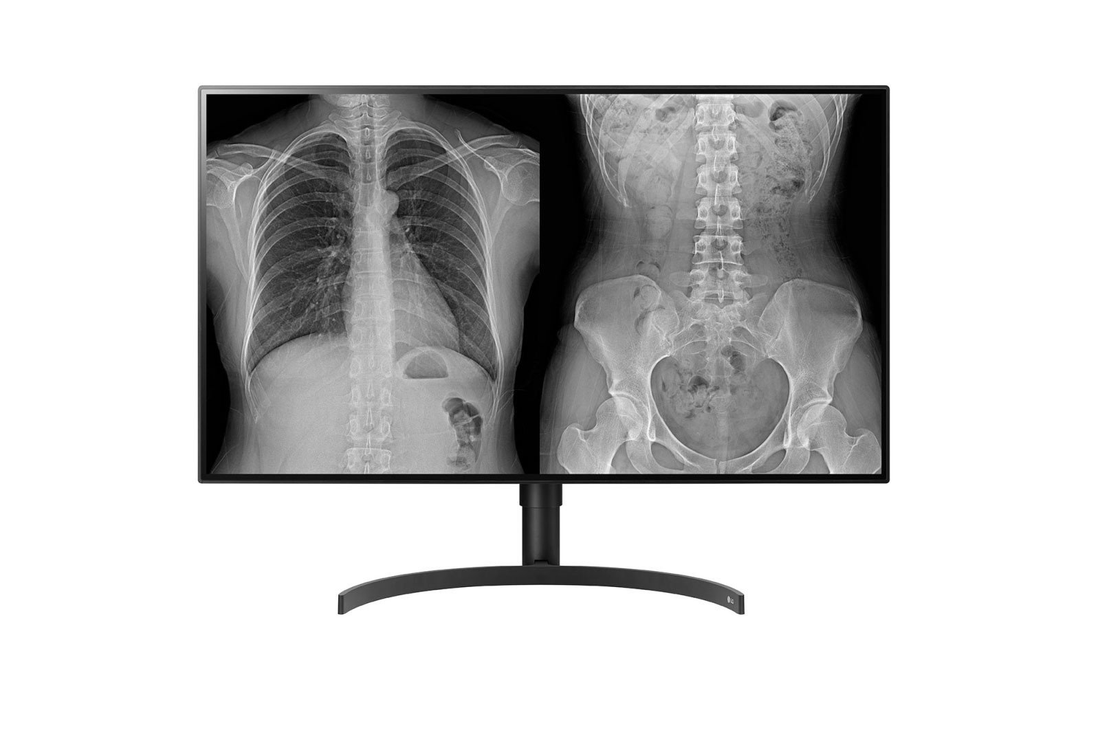 LG 32HL512D-B 32″ 4K LED Monitor with HDR10 and IPS Pa...